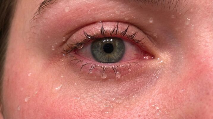 lentilles-piscine-mer-2025.png