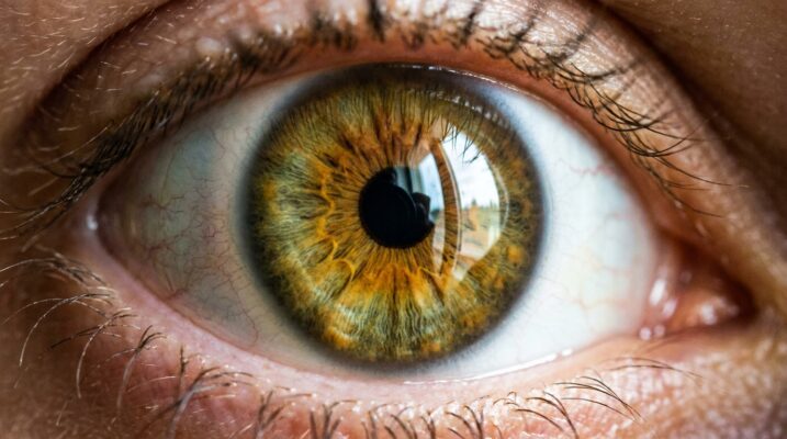 lentilles-toriques-astigmates-2025.png